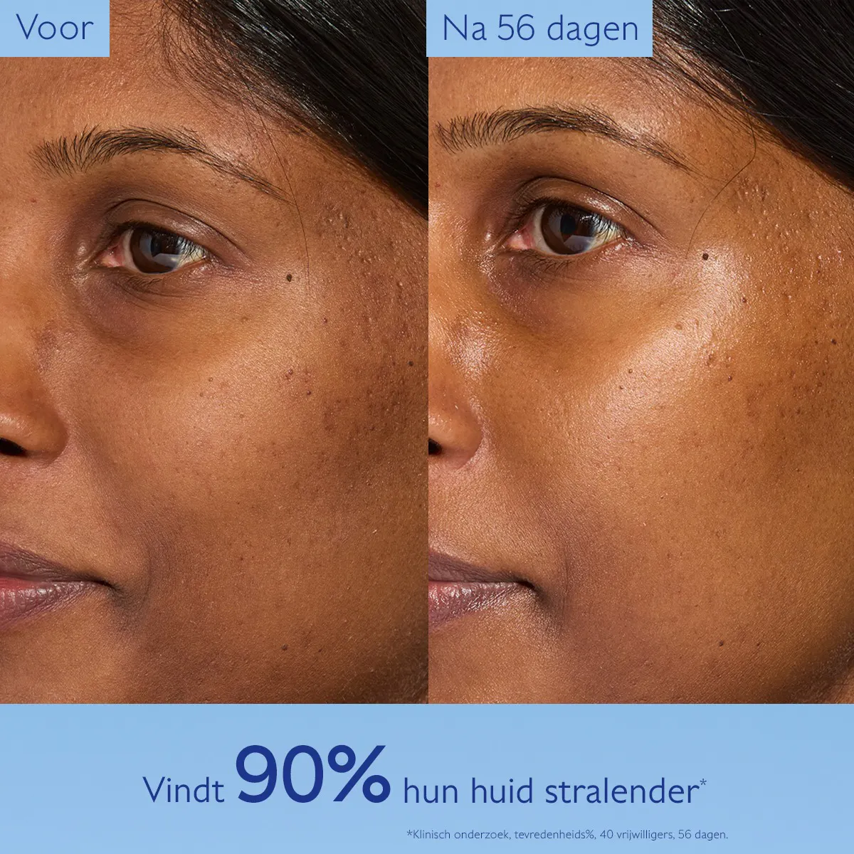 Glycol Nachtcrème tegen Pigmentvlekken