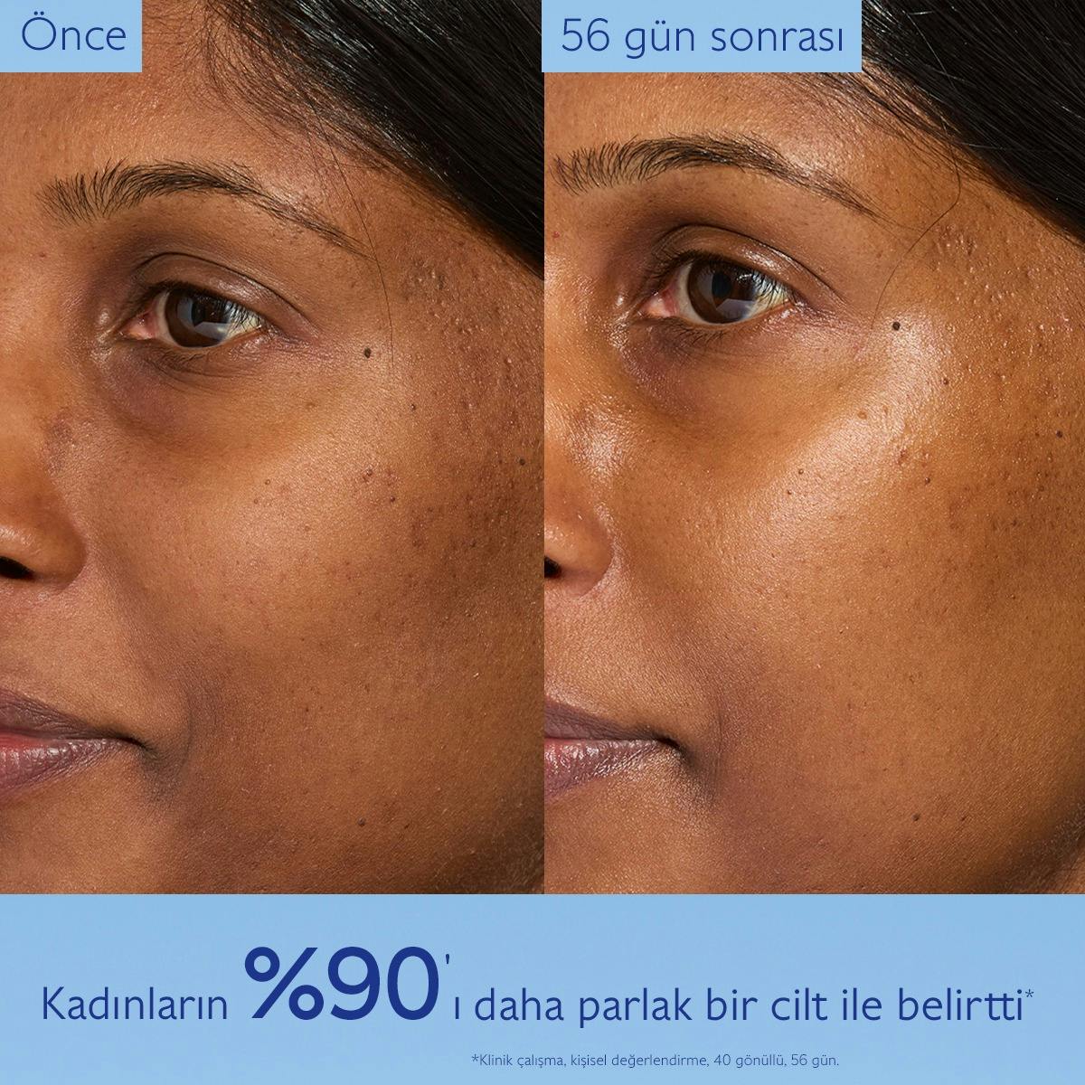 Leke Karşıtı Glikolik Gece Bakım Kremi