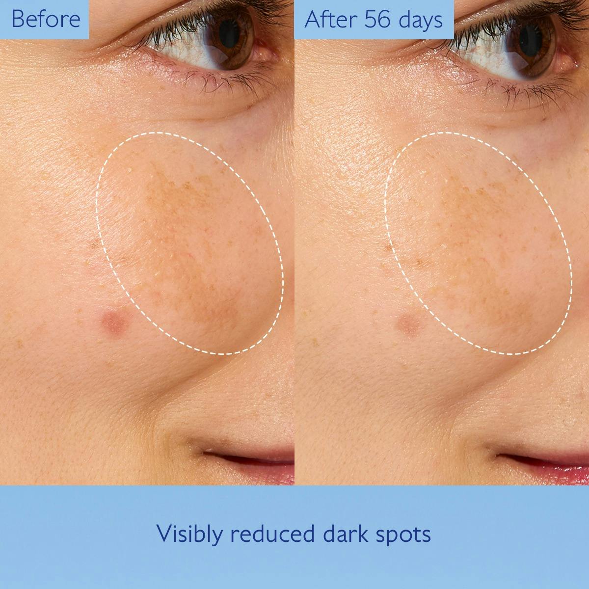 Concentrated Brightening Glycolic Essence