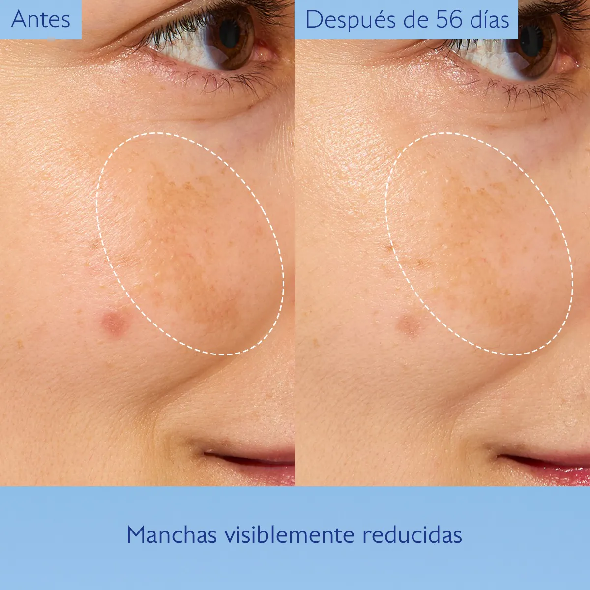 Esencia con Ácido Glicólico Luminosidad