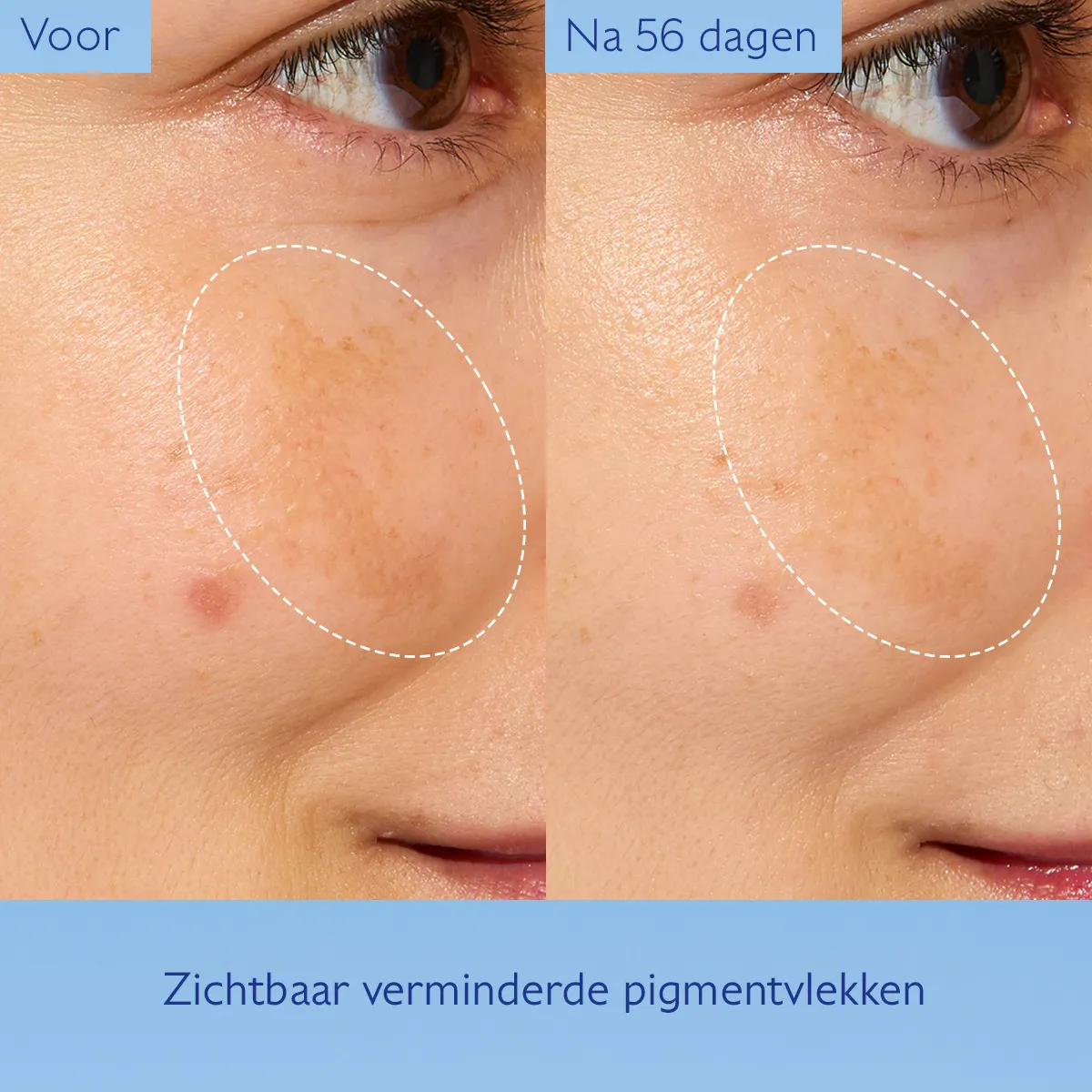 Geconcentreerde Éclat Glycolic Essence