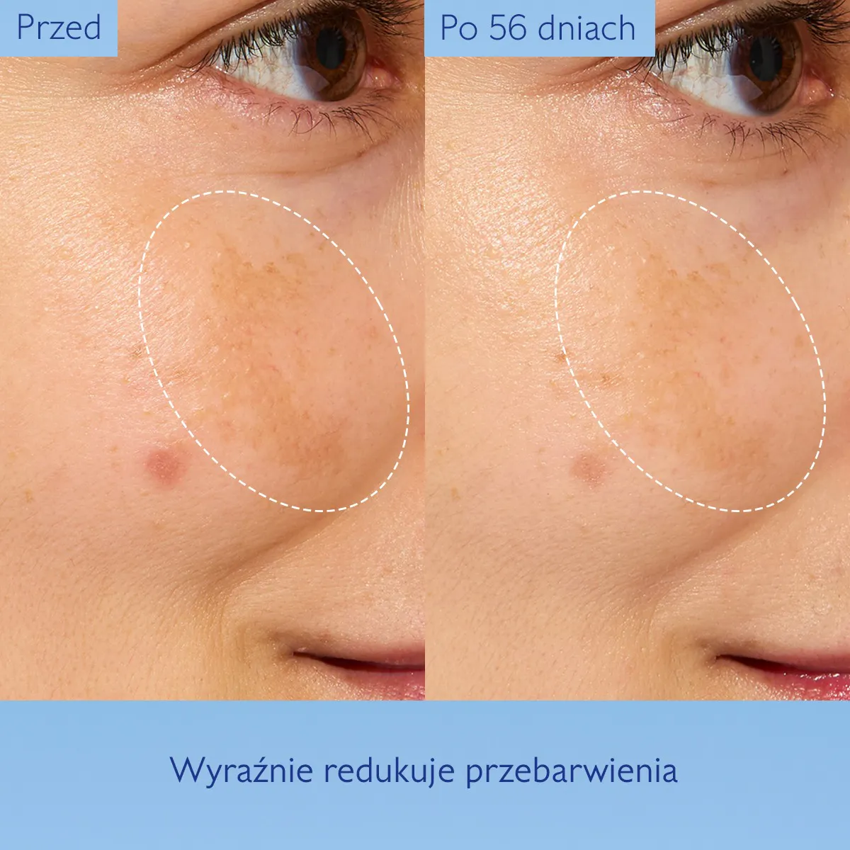 Skoncentrowana Glikolowa Esencja Dodająca Blasku