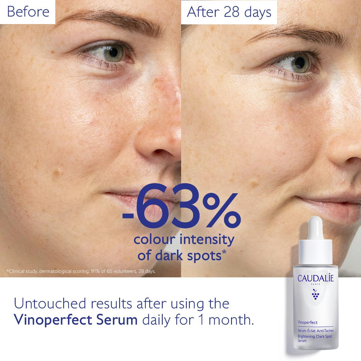 Dark Spot Serum for Radiance - Vinoperfect | Caudalie®