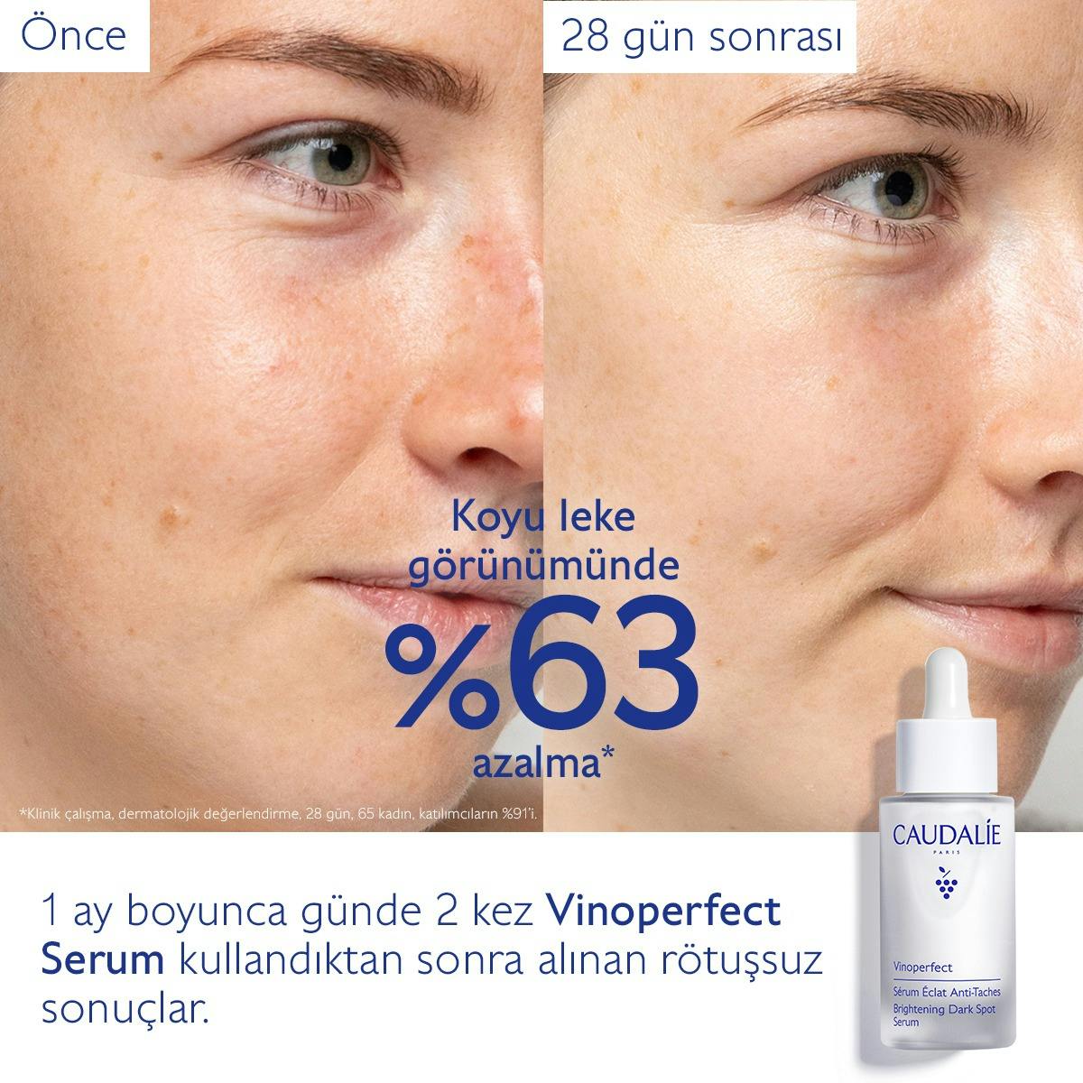 Leke Karşıtı Işıltı Verici Serum - 50ml