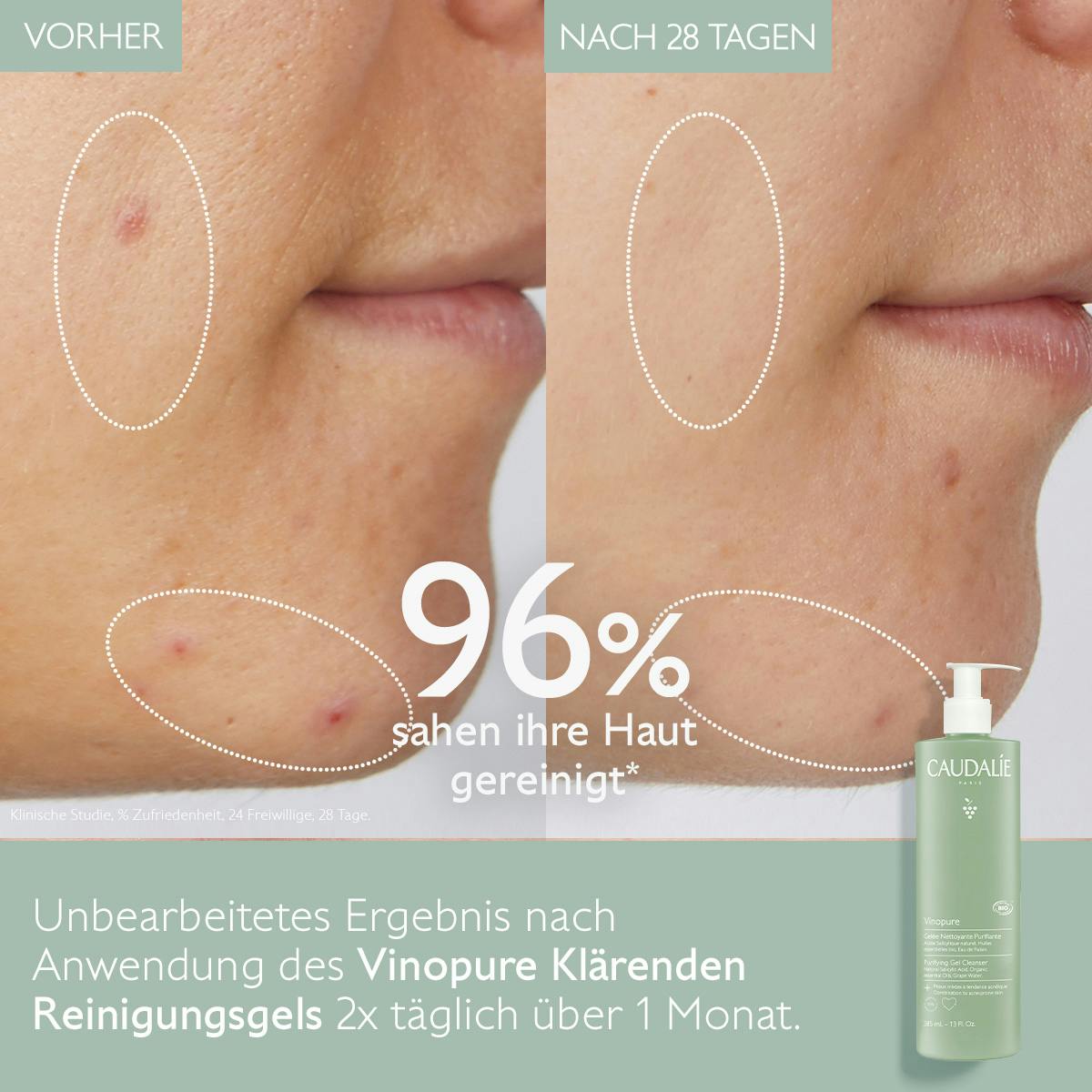 Klärendes Reinigungsgel mit Salicylsäure - 385mL