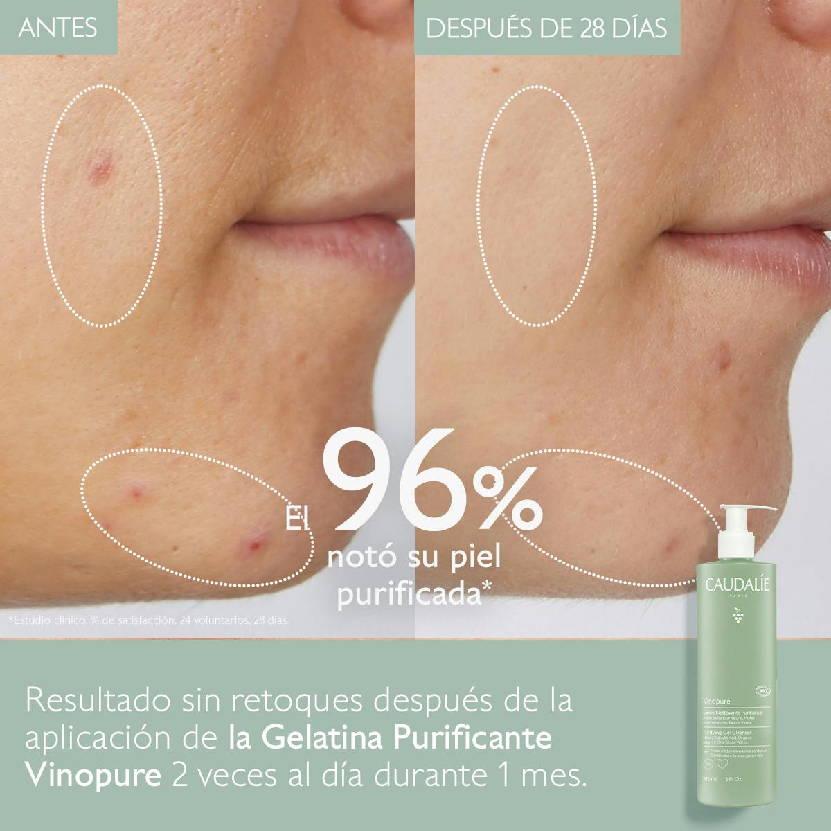 Gelatina Limpiadora Purificante con Ácido Salicílico - 385ml