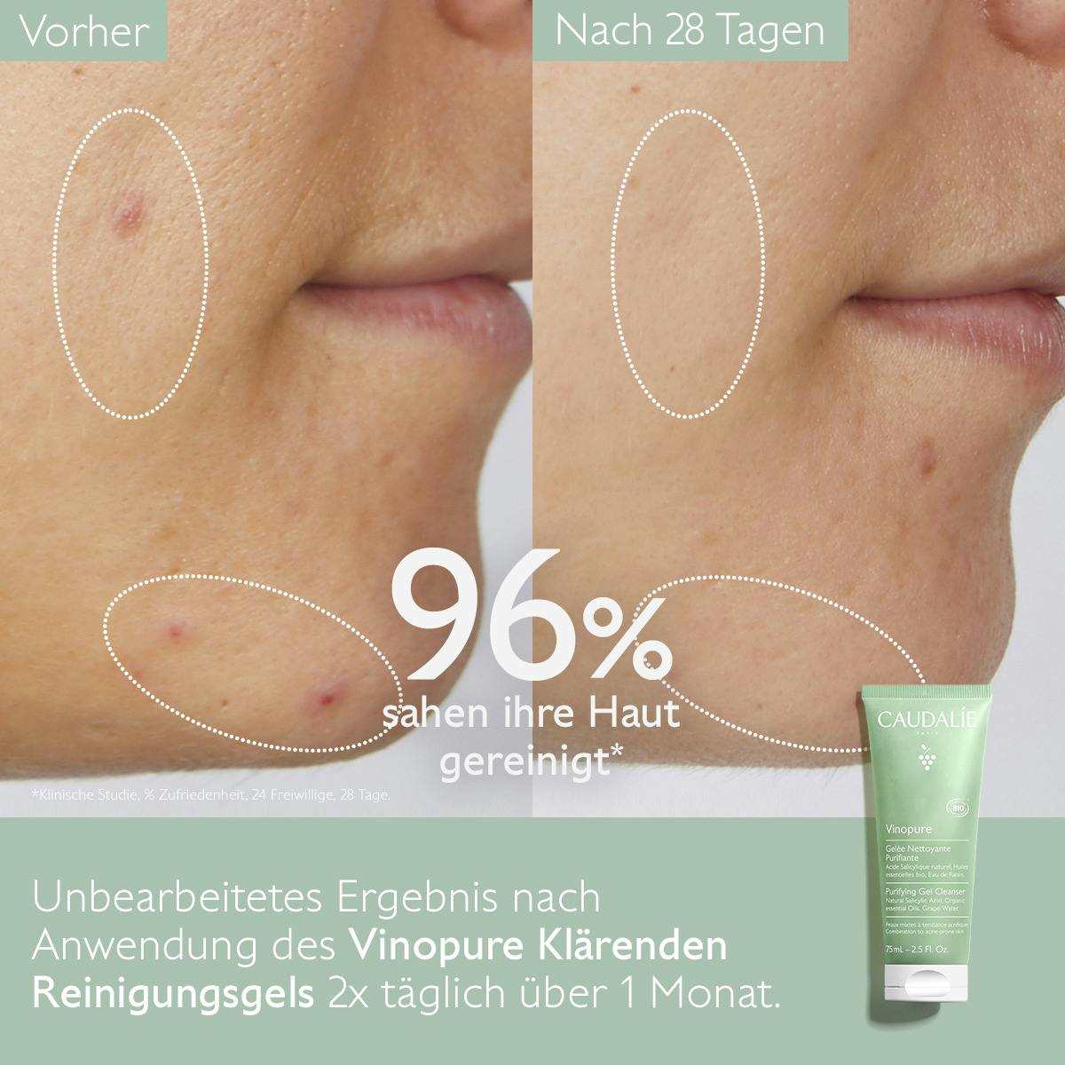 Klärendes Reinigungsgel mit Salicylsäure - 75mL