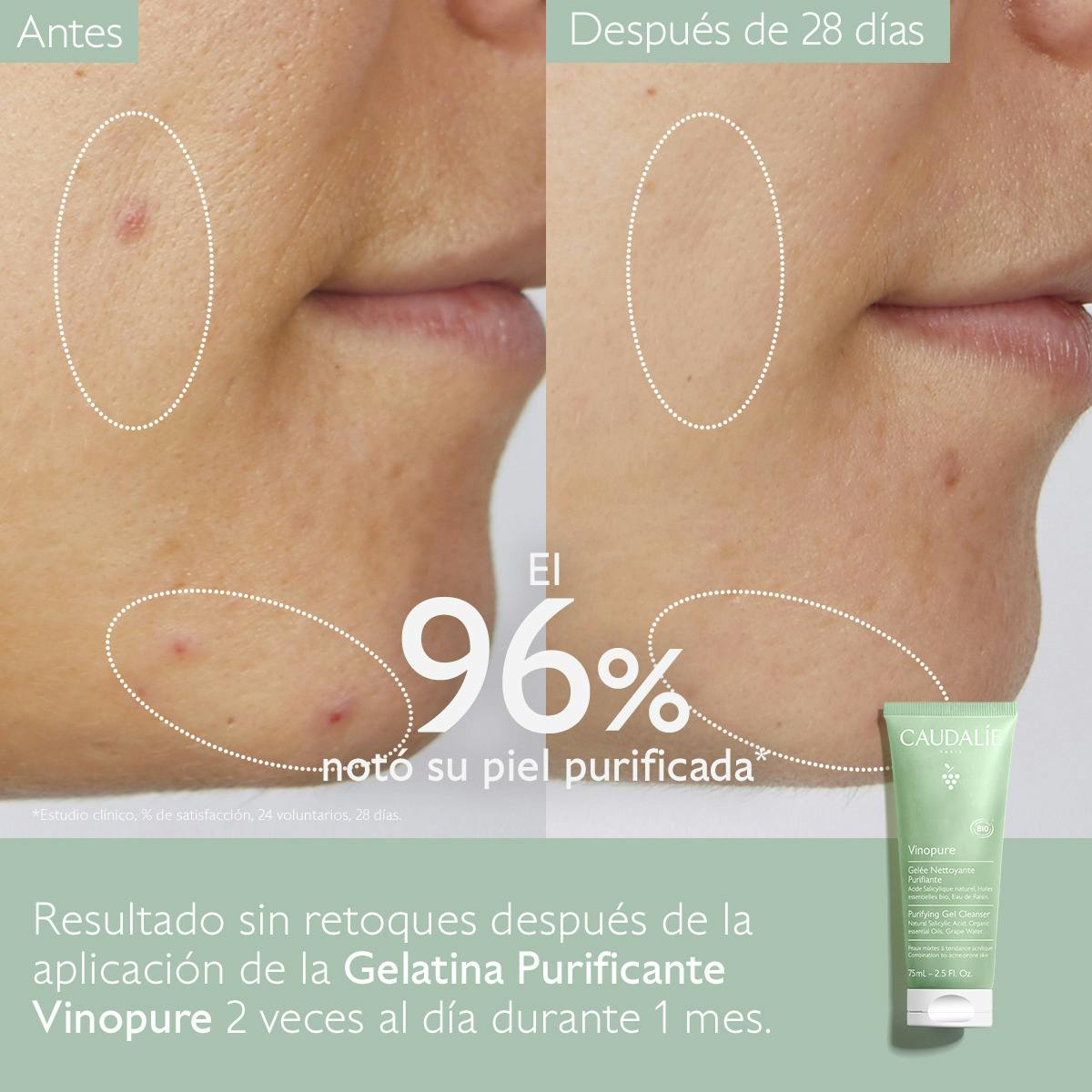 Gelatina Limpiadora Purificante con Ácido Salicílico - 75ml