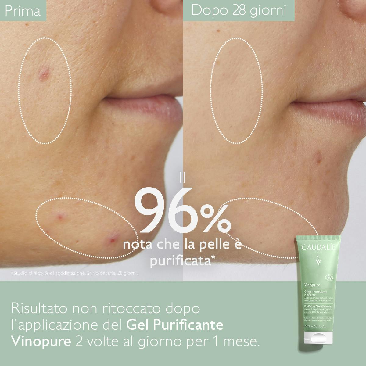 Gel Detergente Purificante con Acido Salicilico - 75ml