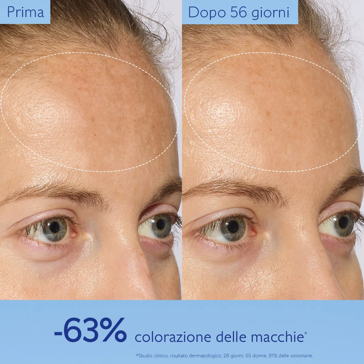Siero Illuminante Anti-Macchie con Viniferina, Alternativa alla Vitamina C