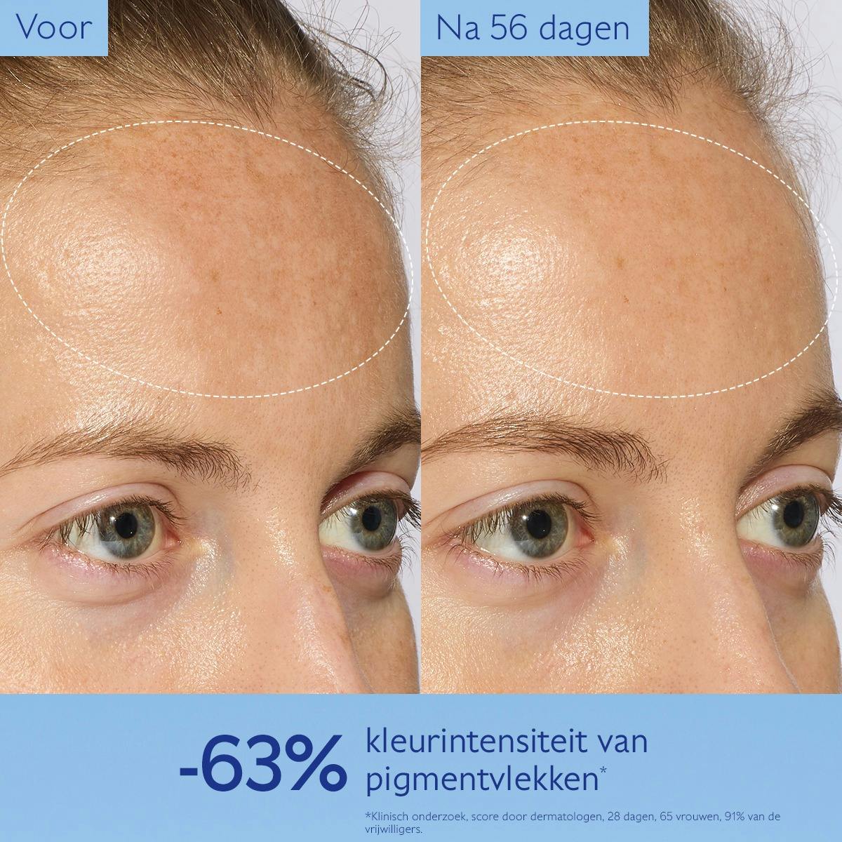 Serum Stralende Huid tegen Vlekken