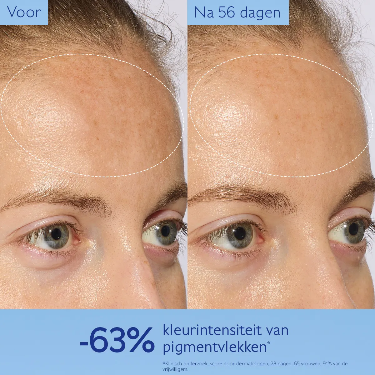 Serum Stralende Huid tegen Vlekken
