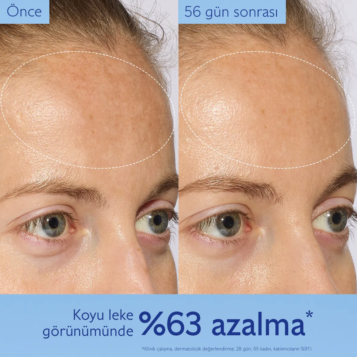 Dark Spot Brightening Serum Vitamin C Alternative