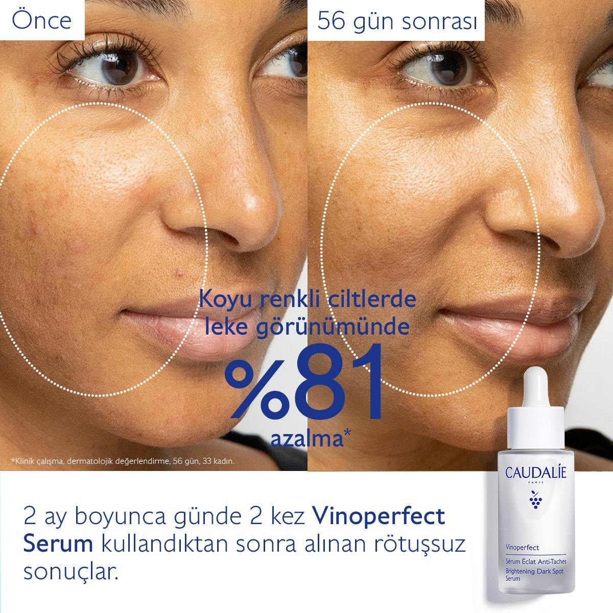 Leke Karşıtı Işıltı Verici Serum - 50ml