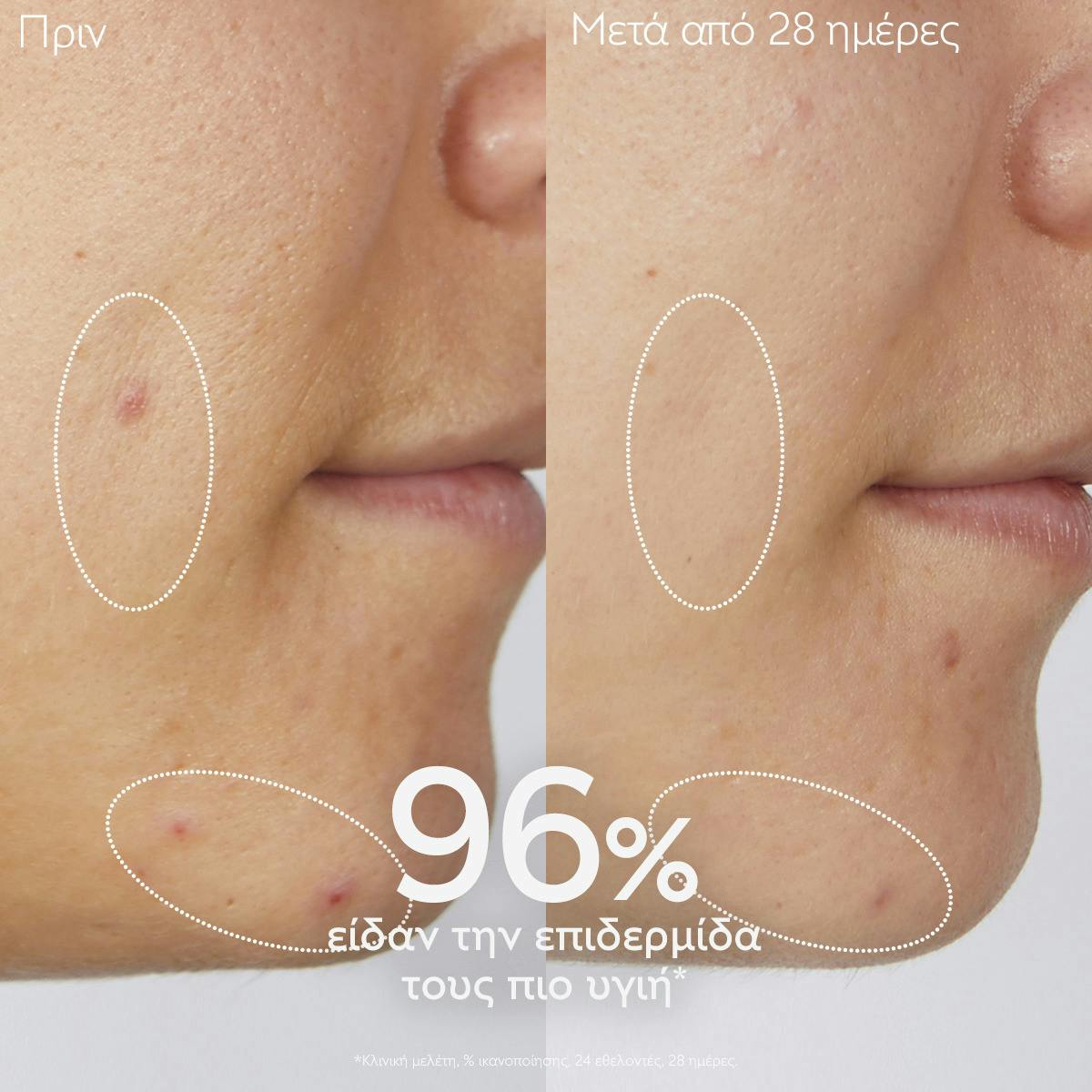 Purifying Gel Cleanser