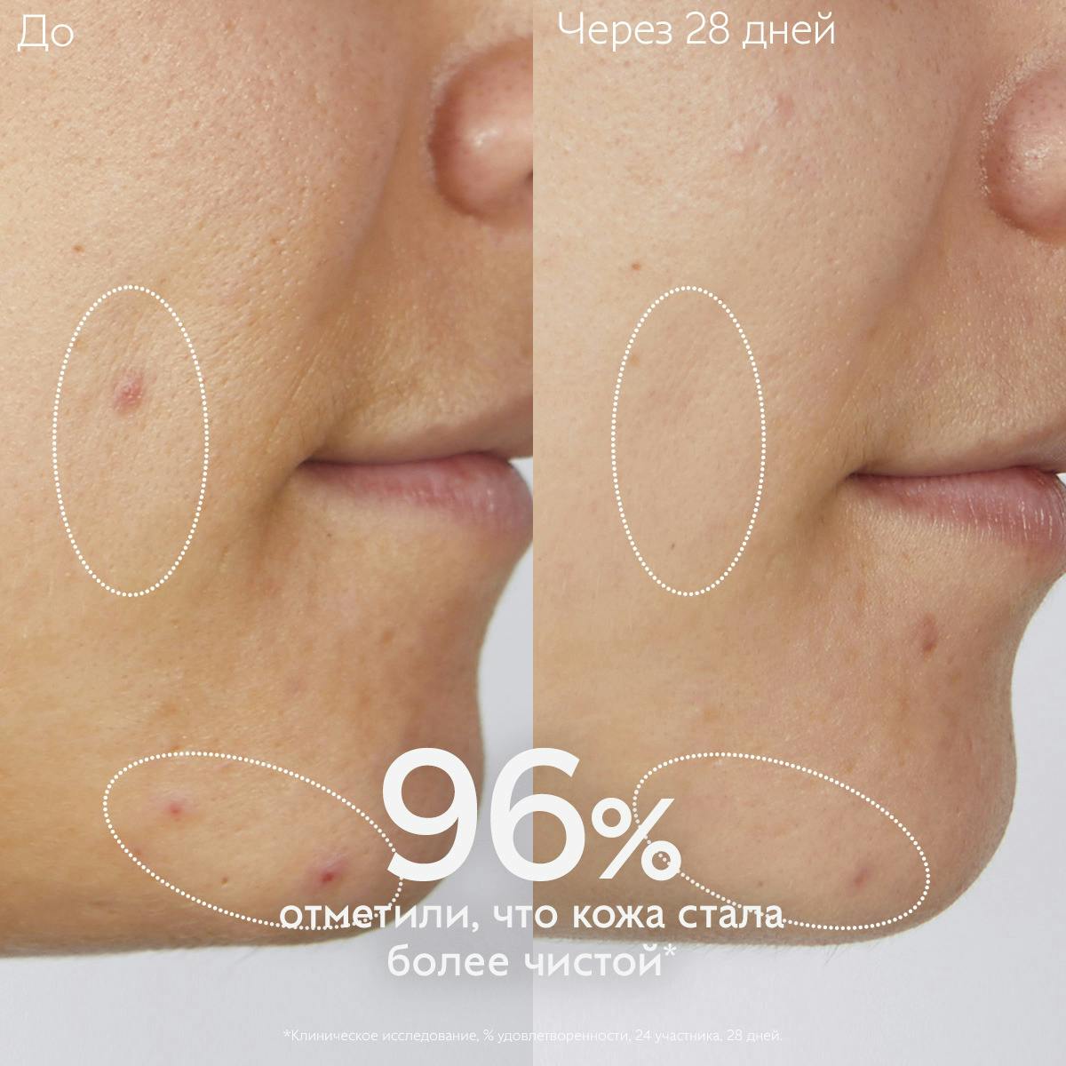 Очищающий гель для умывания