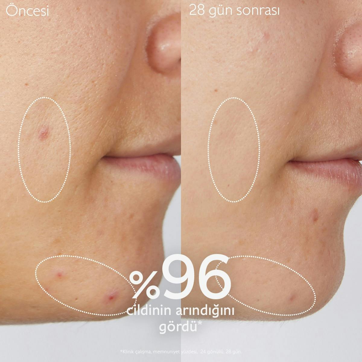 Arındırıcı Temizleme Jeli