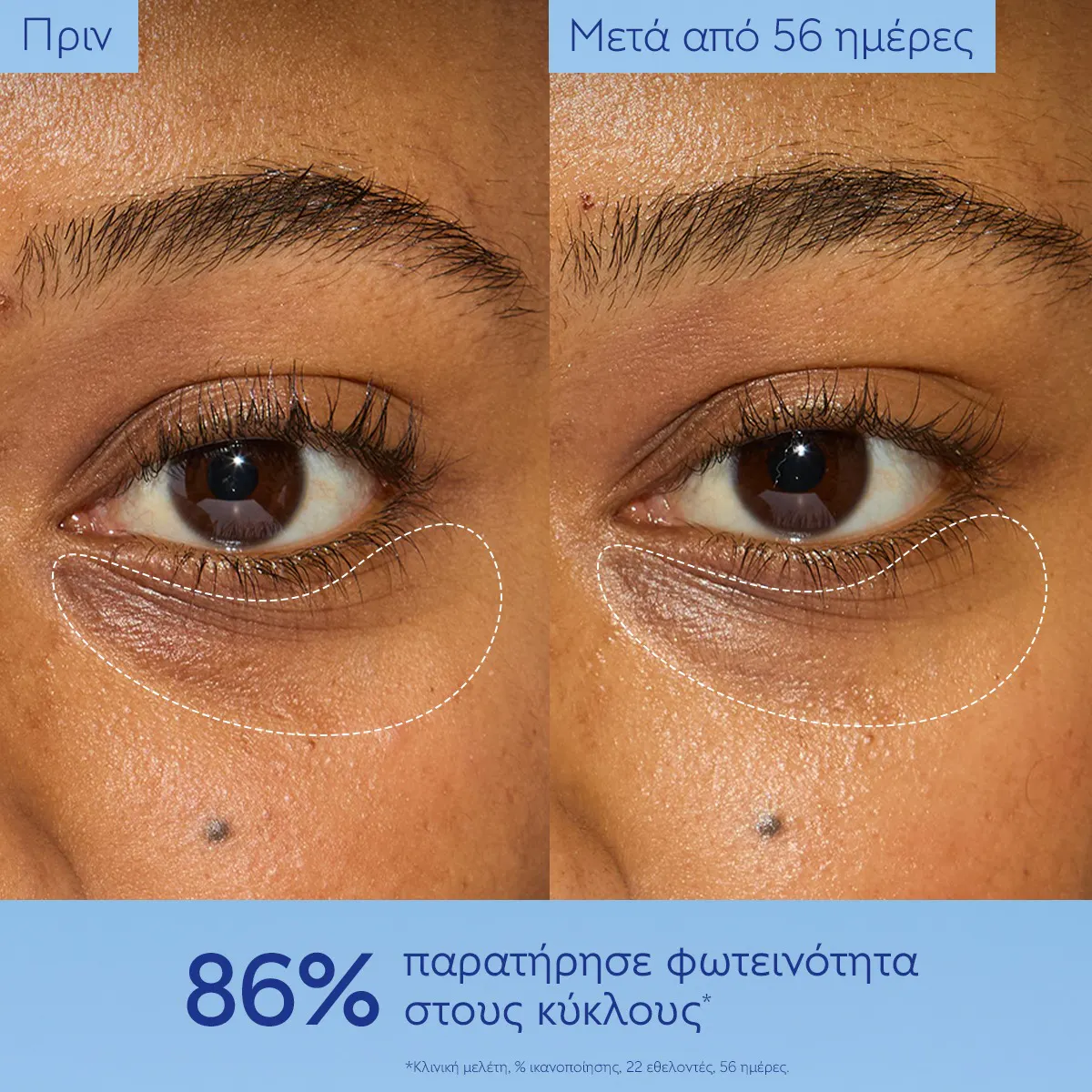 Brightening Eye Cream