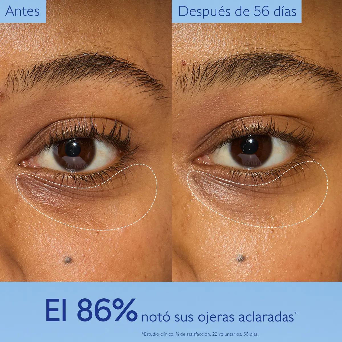 Tratamiento de Ojos Iluminador Nacinamida + Cafeína