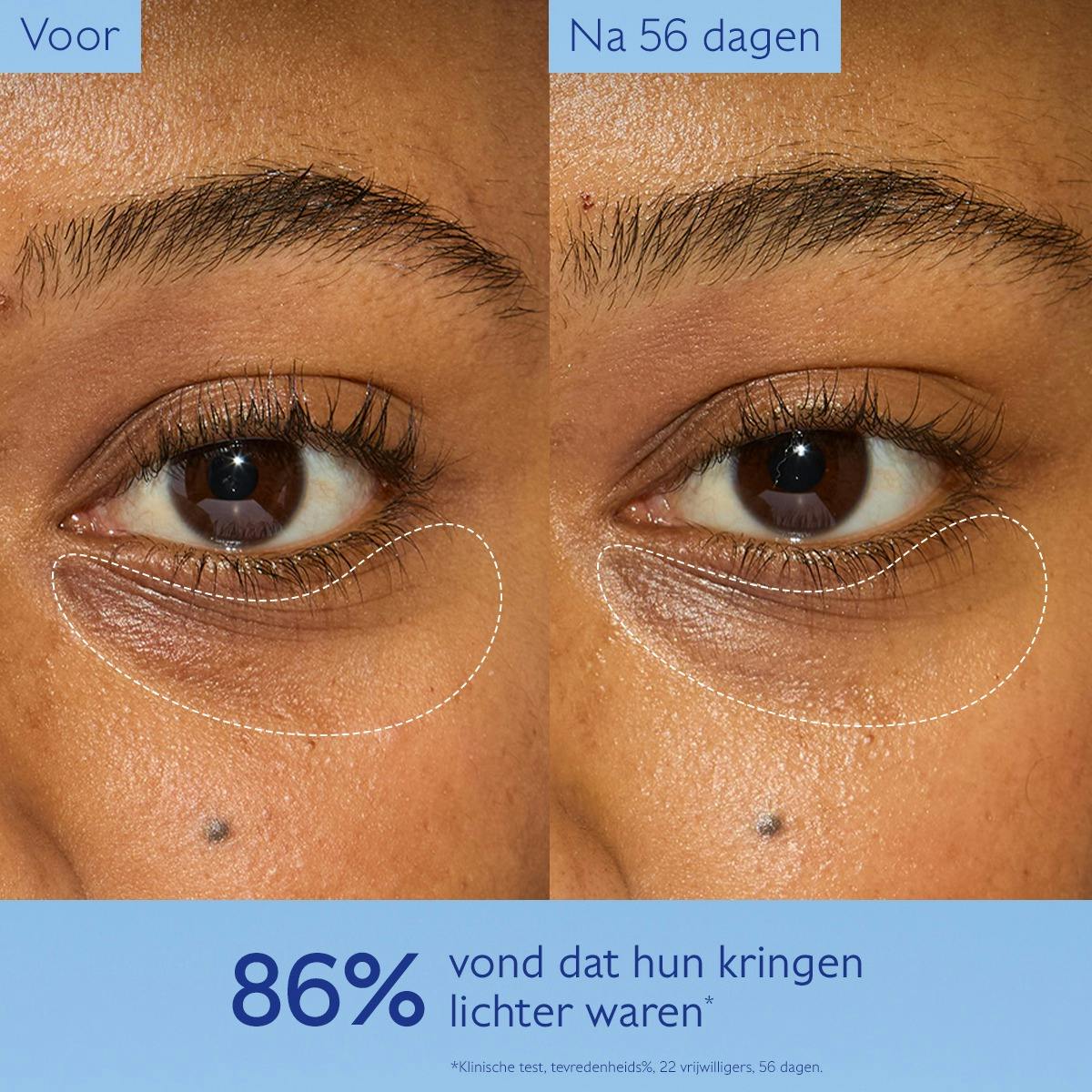 Verhelderende Oogverzorging