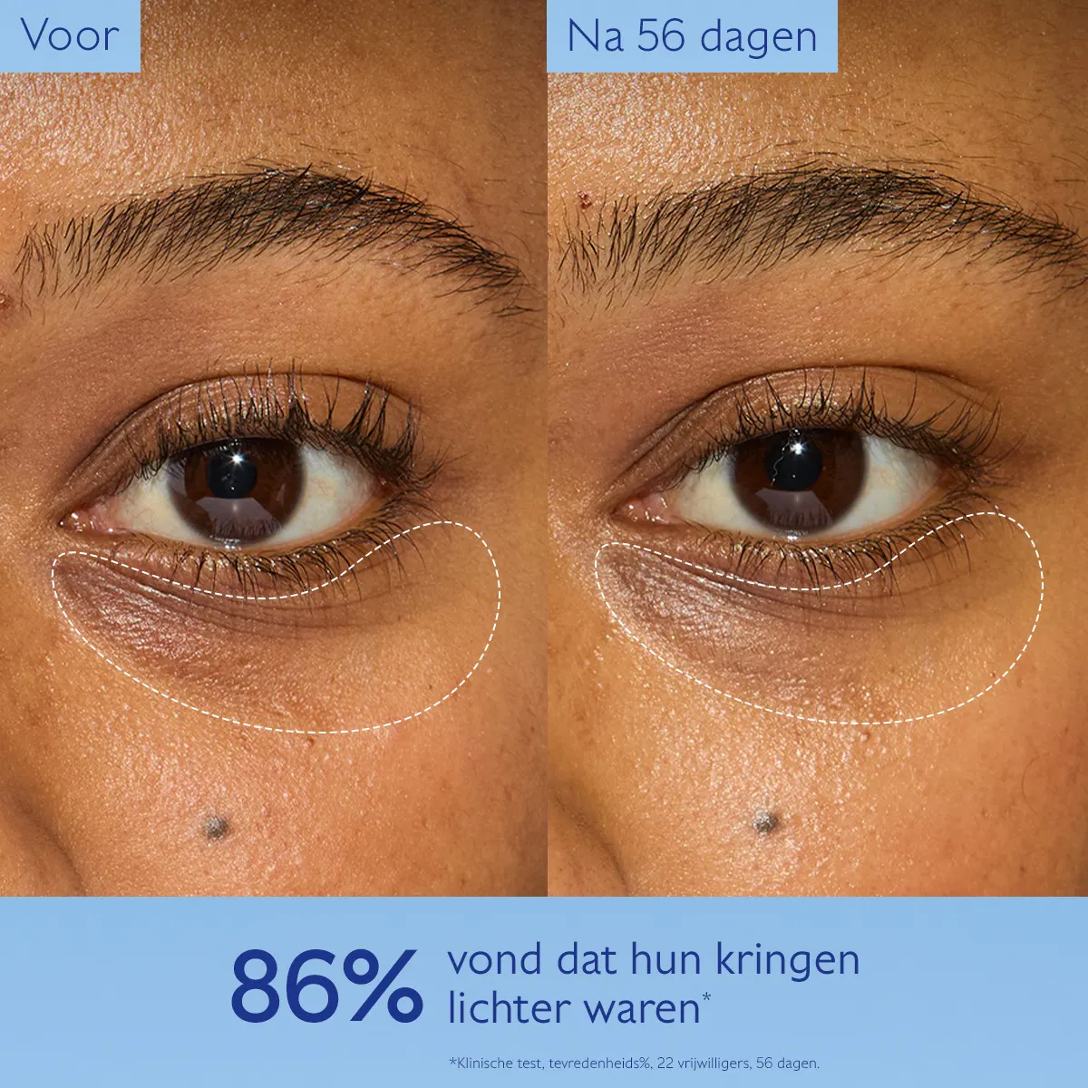 Verhelderende Oogverzorging