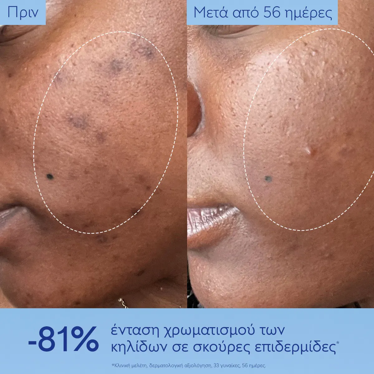 Brightening Dark Spot Serum Vitamin C Alternative