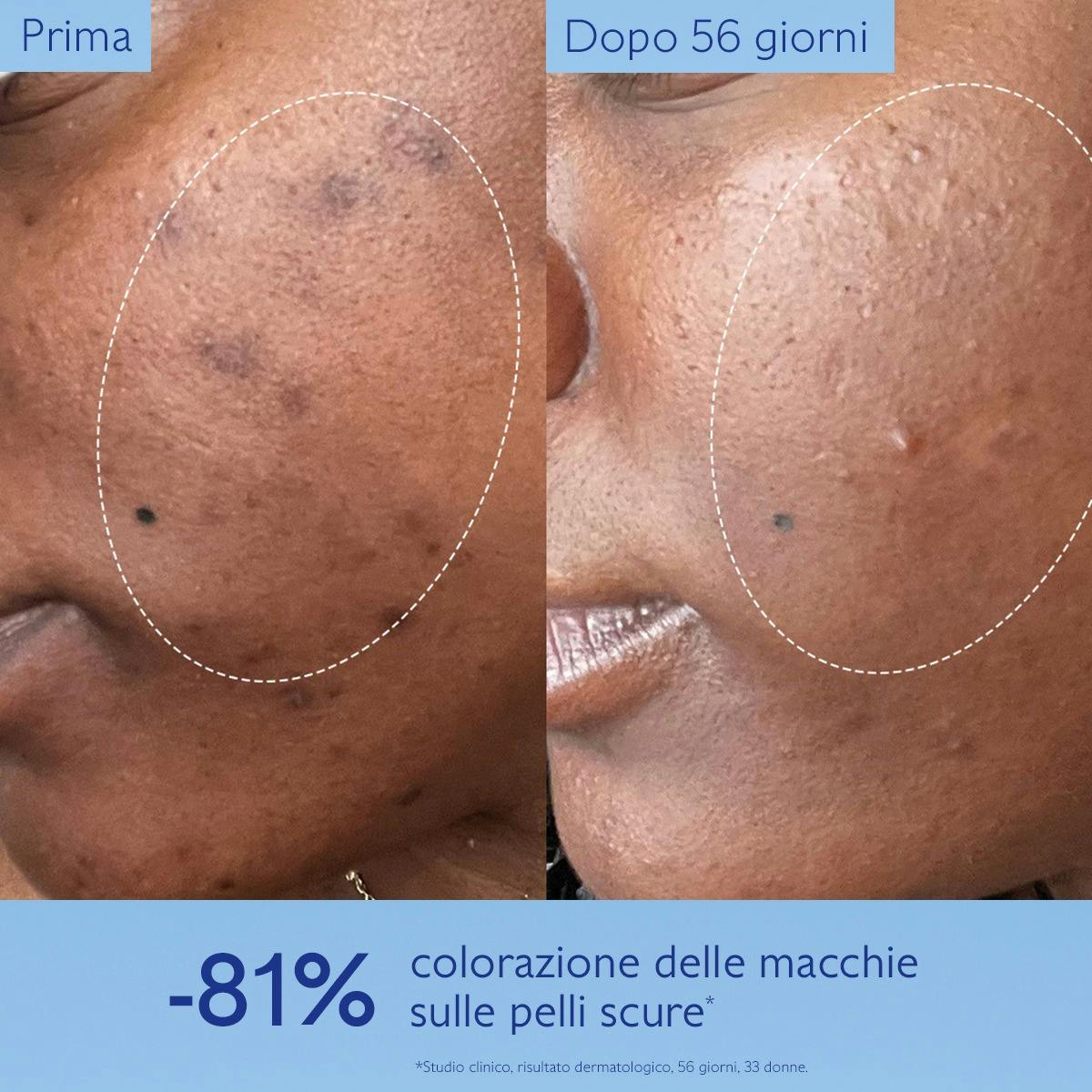 Siero Illuminante Anti-Macchie con Viniferina, Alternativa alla Vitamina C