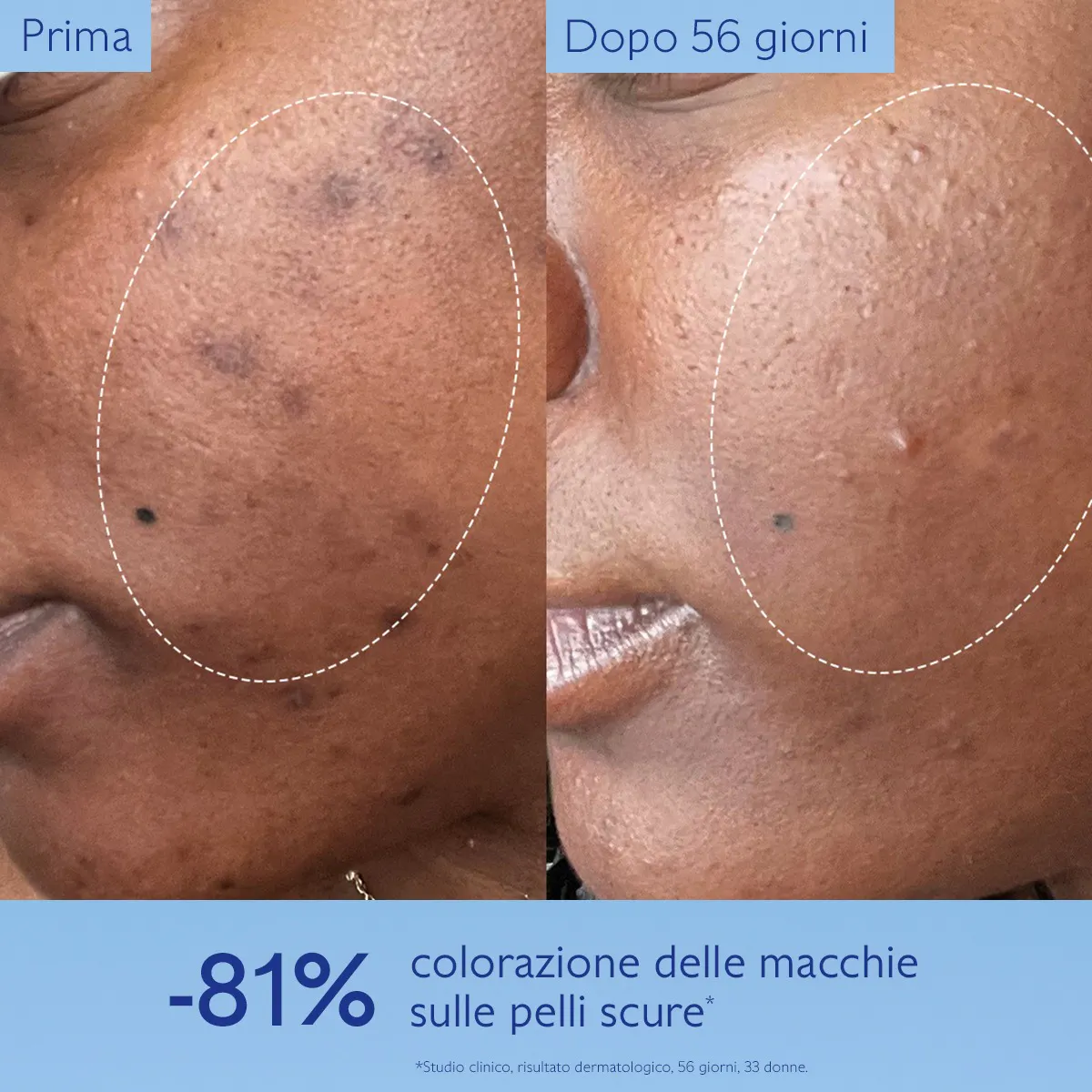 Siero Illuminante Anti-Macchie con Viniferina, Alternativa alla Vitamina C
