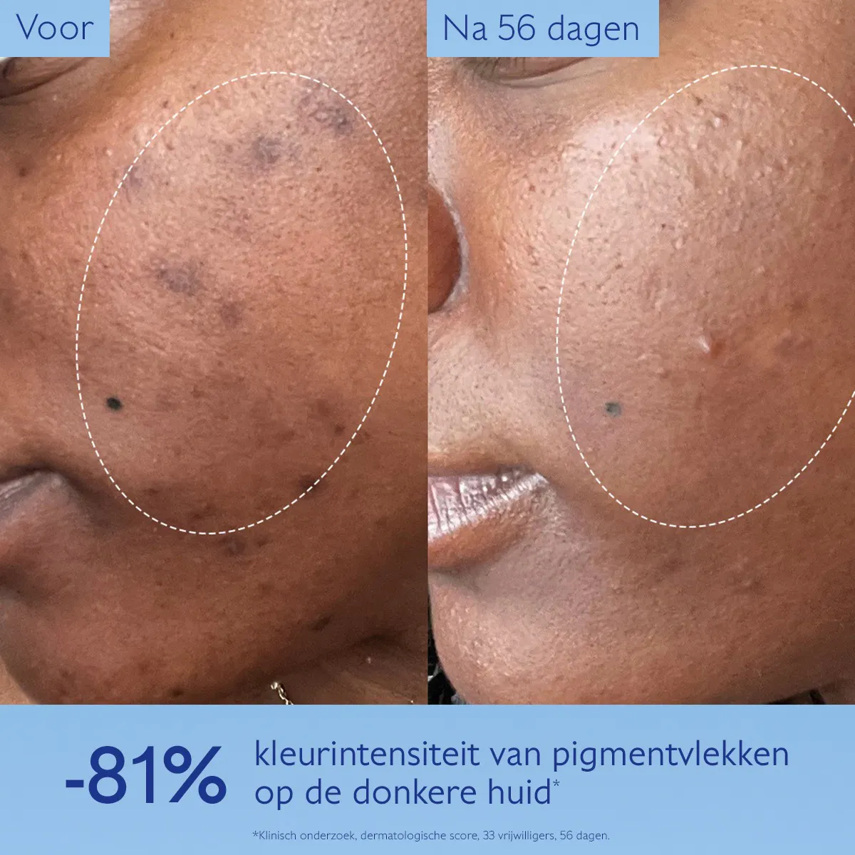 Serum Stralende Huid tegen Vlekken