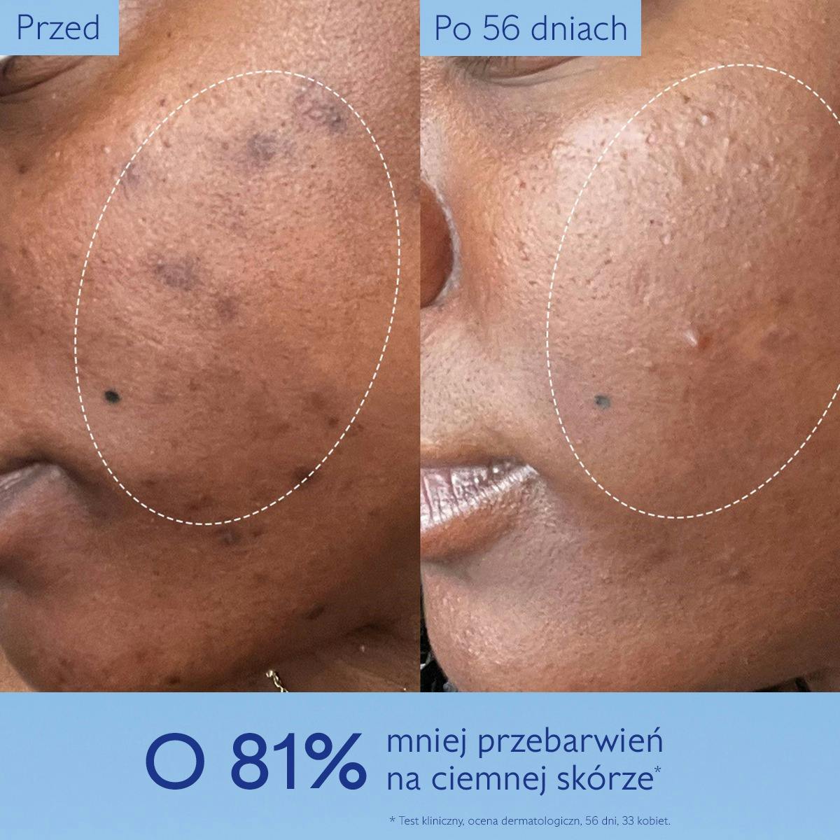 Serum Rozjaśniające Przebarwienia - 50ml