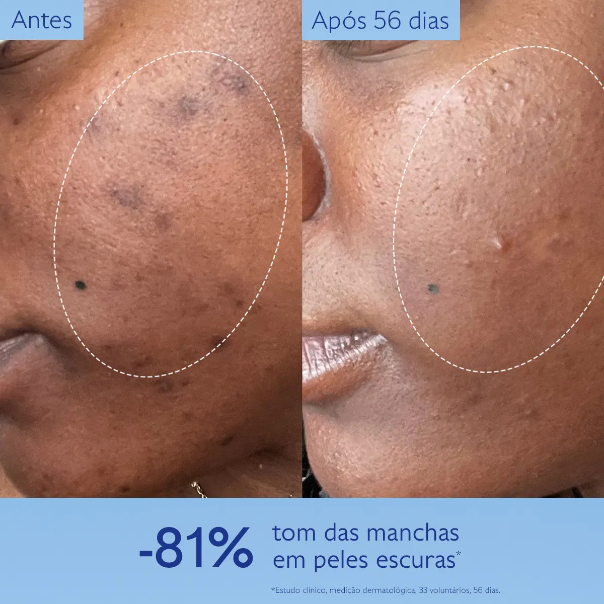 Sérum Luminosidade Antimanchas