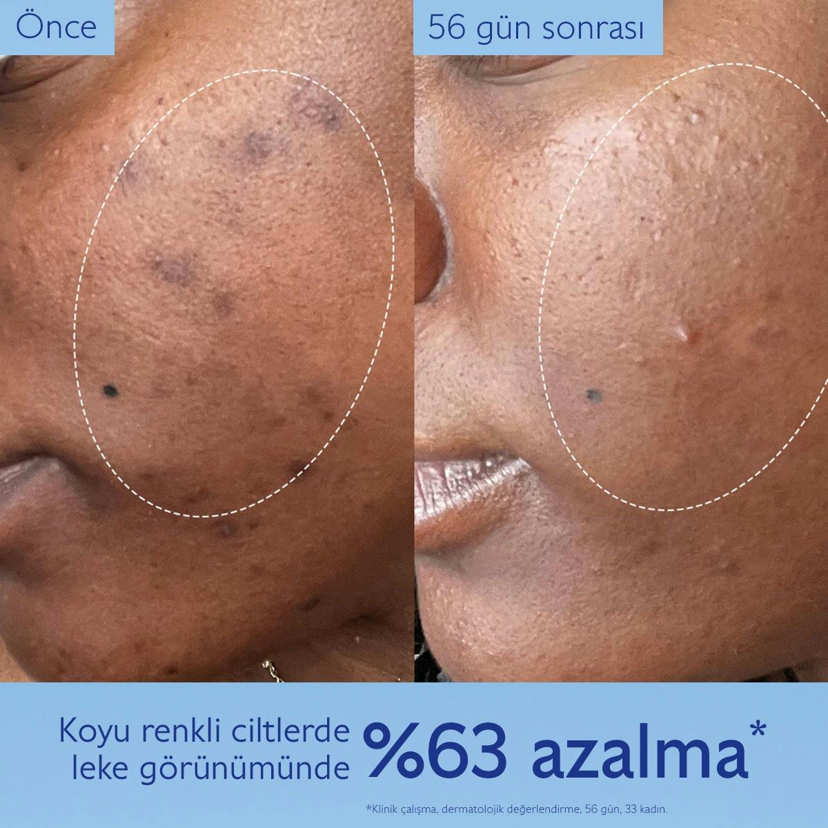 Leke Karşıtı Işıltı Verici Serum - 50ml