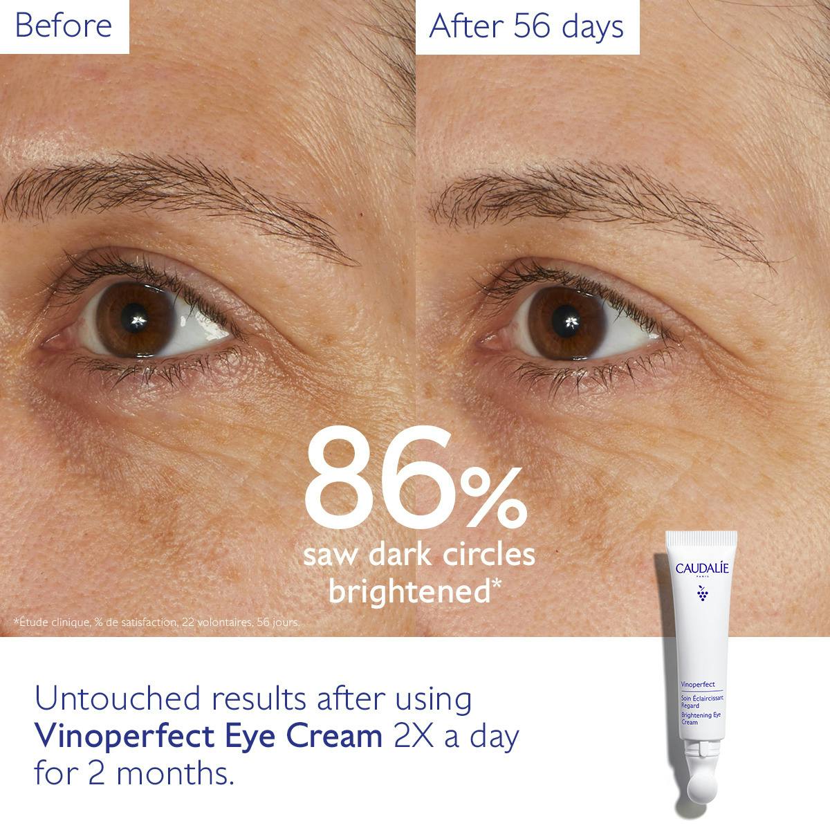 Dark Circle Brightening Eye Cream with Niacinamide