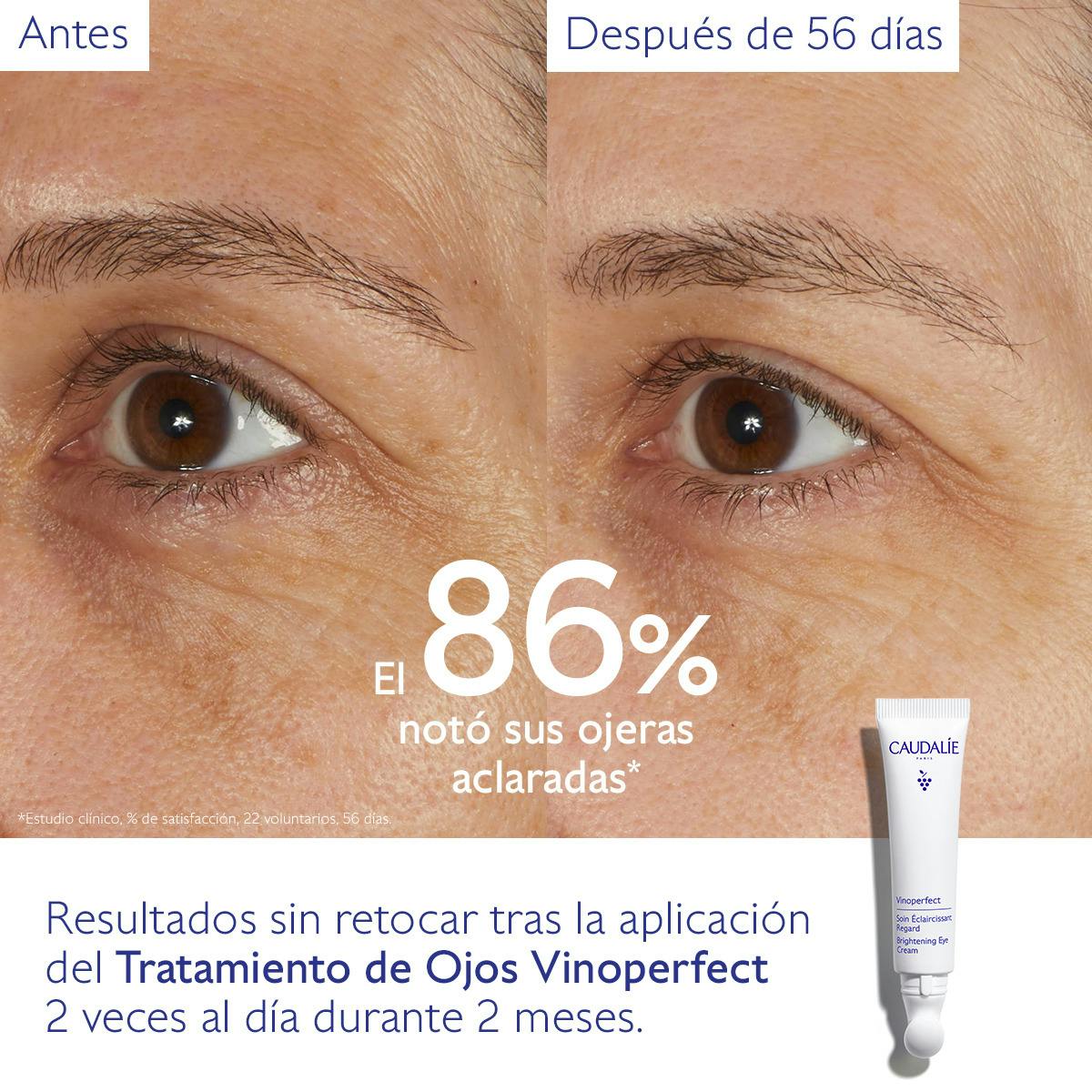 Tratamiento de Ojos Iluminador Nacinamida + Cafeína