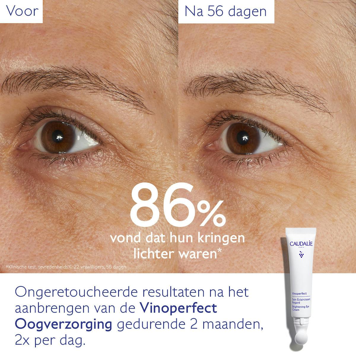 Verhelderende Oogverzorging