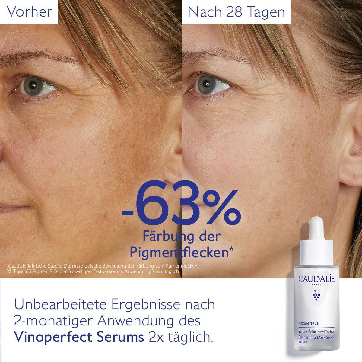 Serum für mehr Ausstrahlung und gegen Pigmentflecken mit Viniferine, Alternative zu Vitamin C