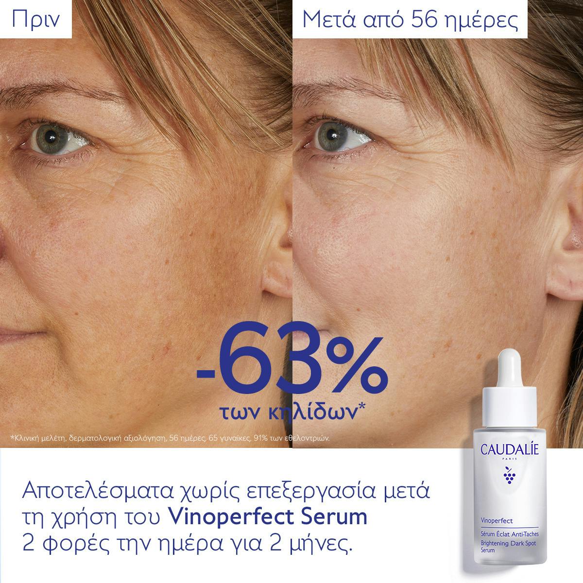 Brightening Dark Spot Serum Vitamin C Alternative