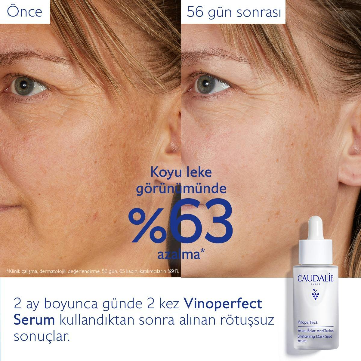 Leke Karşıtı Işıltı Verici Serum - 50ml