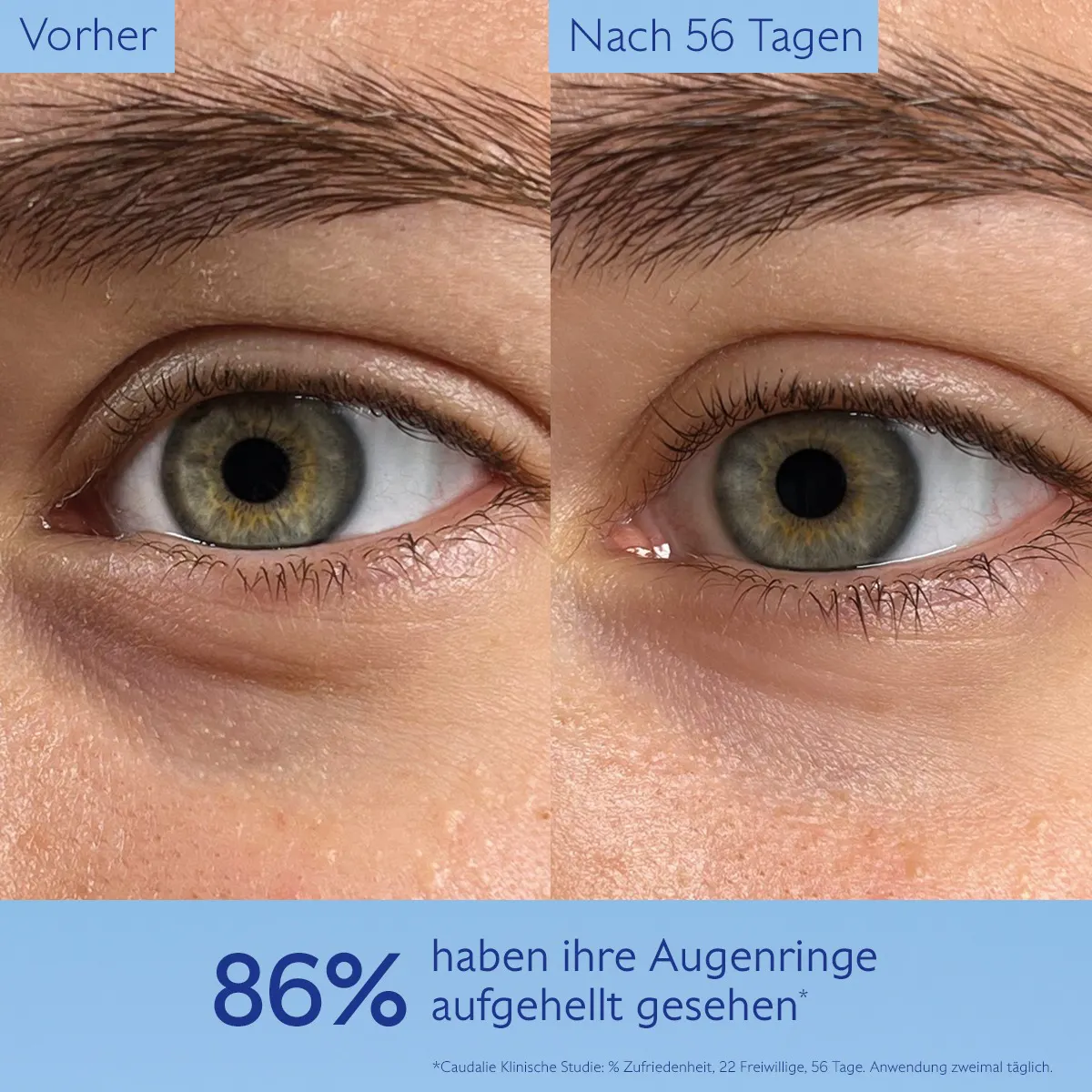 Aufhellende Augenpflege mit Koffein & Niacinamid