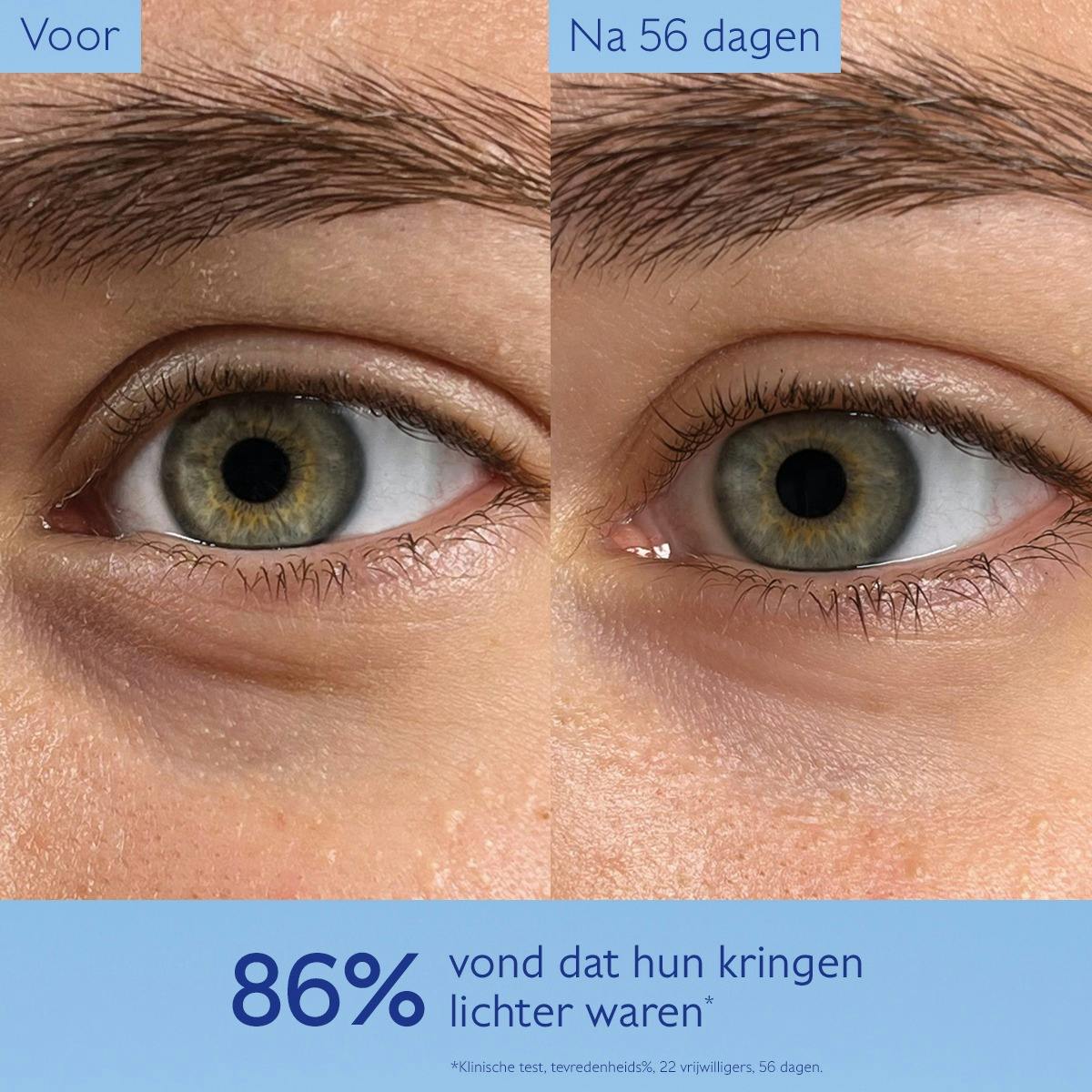 Verhelderende Oogverzorging