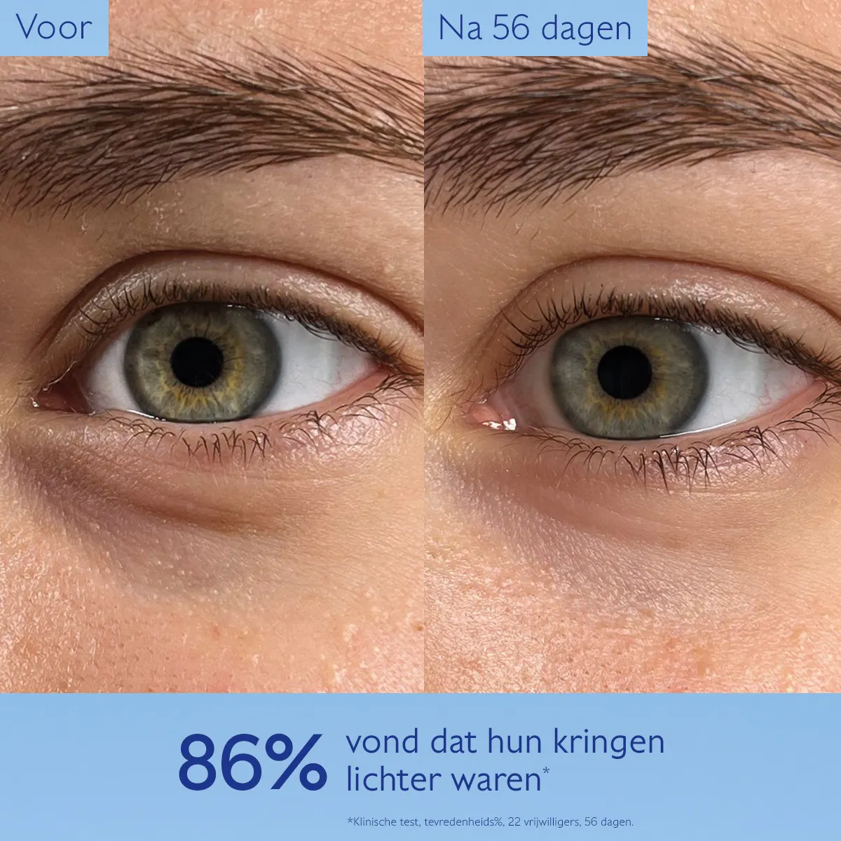 Verhelderende Oogverzorging