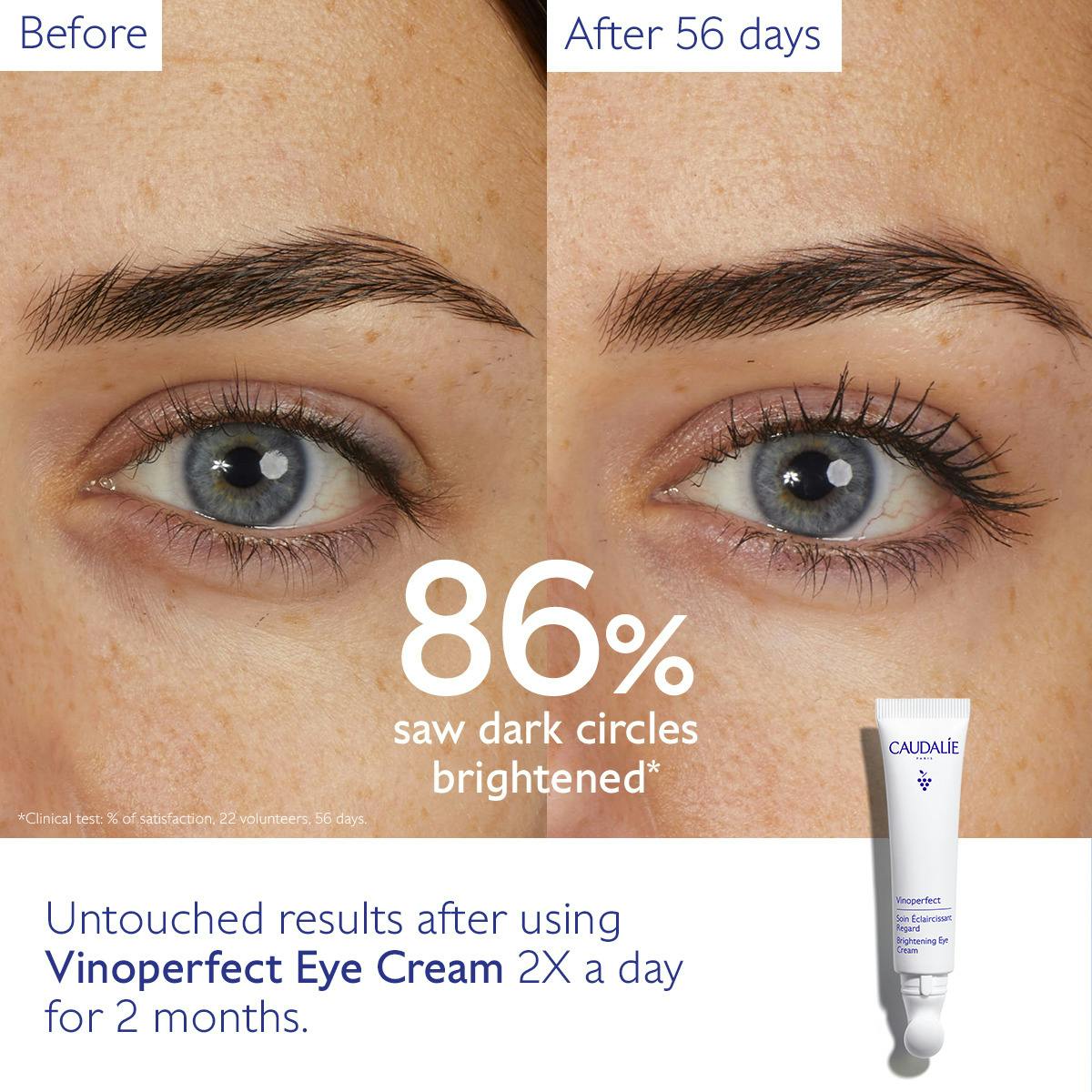 Dark Circle Brightening Eye Cream with Niacinamide