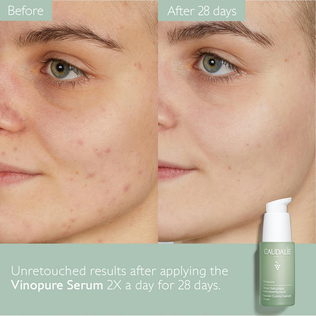 Salicylic Acid Serum Vinopure Caudalie