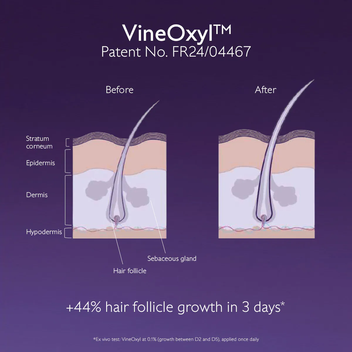 Anti-Hair Loss Serum