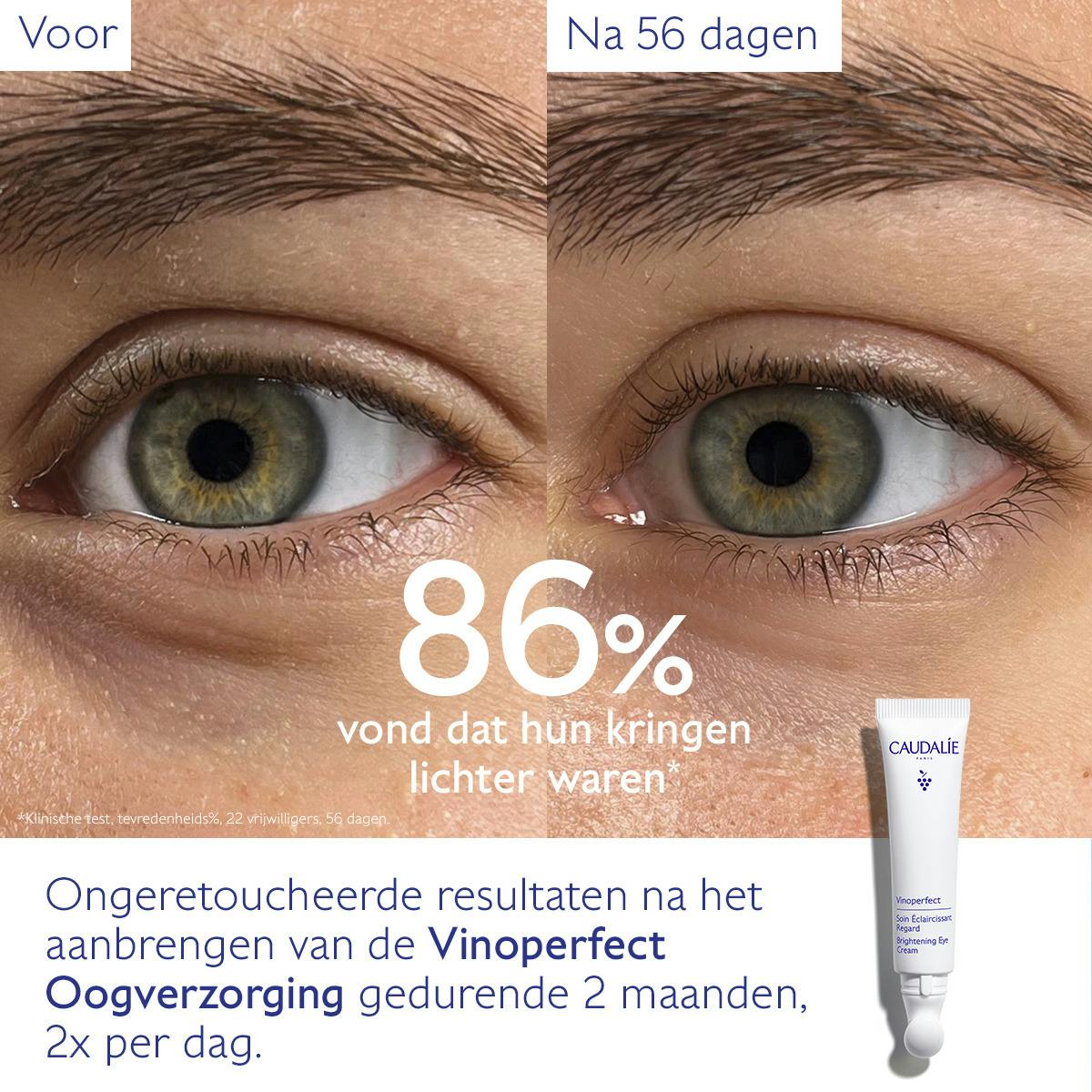 Verhelderende Oogverzorging