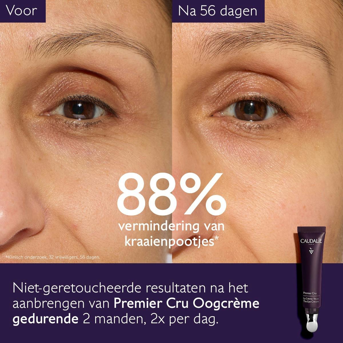De Oogcrème